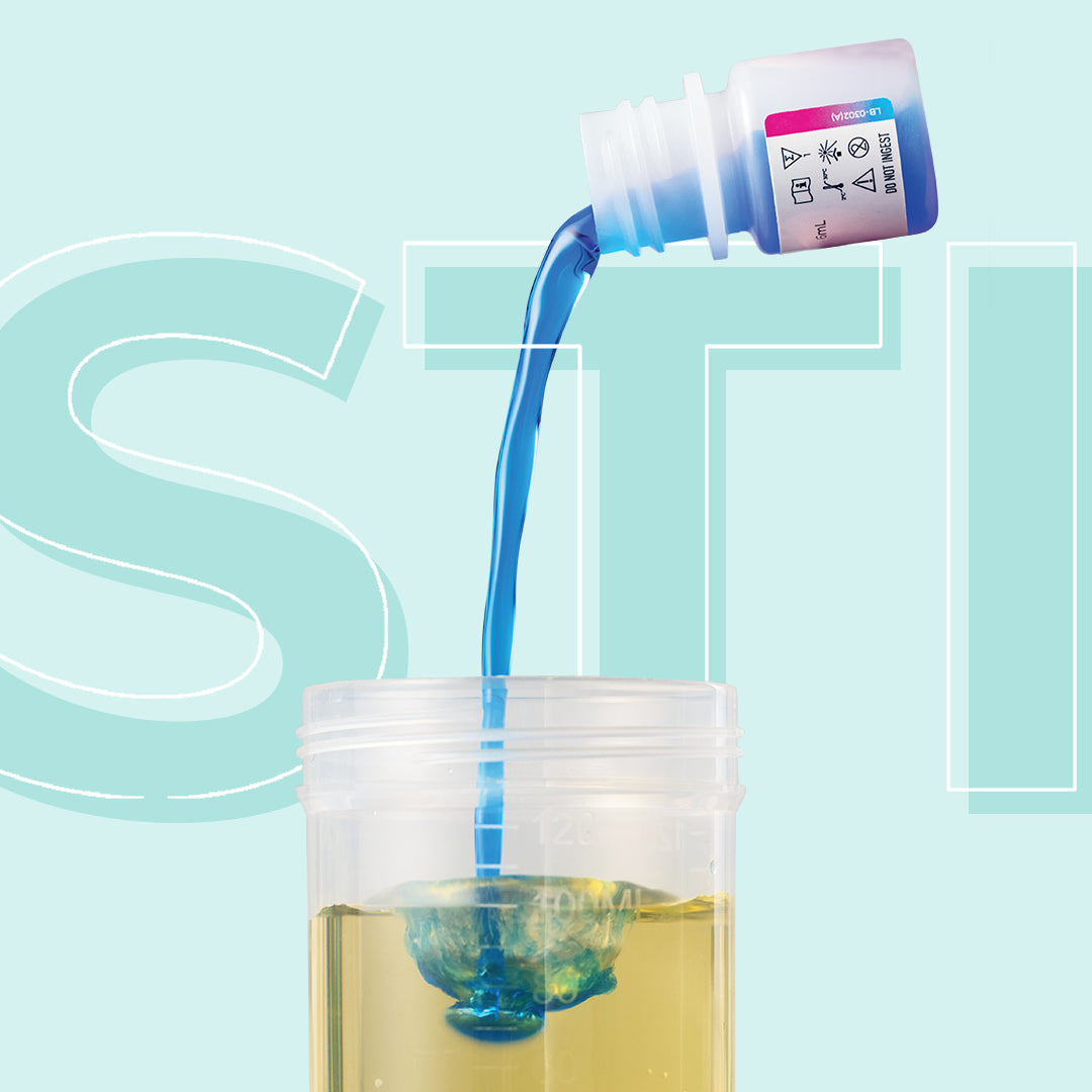 性病尿液自採樣檢測