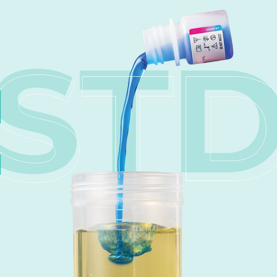 STI (Sexually Transmitted Infection) Urine Test